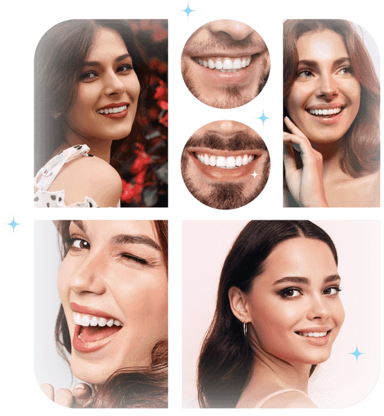 Professional Teeth Whitening Benefits