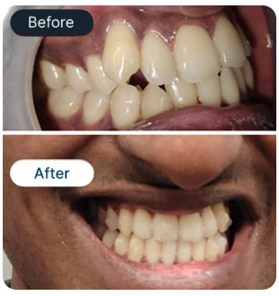 Smile Result
