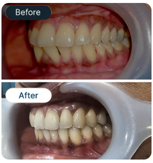 Smile Result
