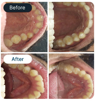 Smile Result