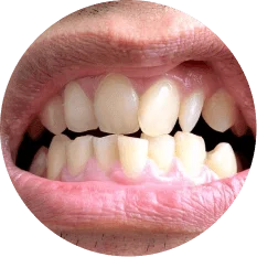 Shape of the Tooth