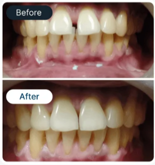 Smile Result