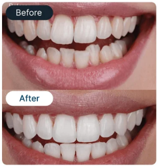Smile Result