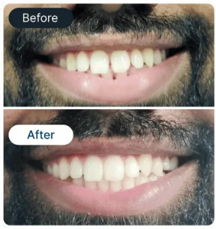 Smile Result