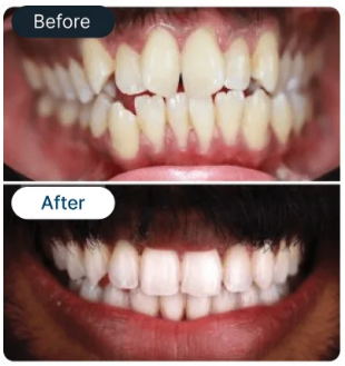 Smile Result