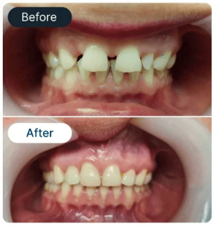 Smile Result